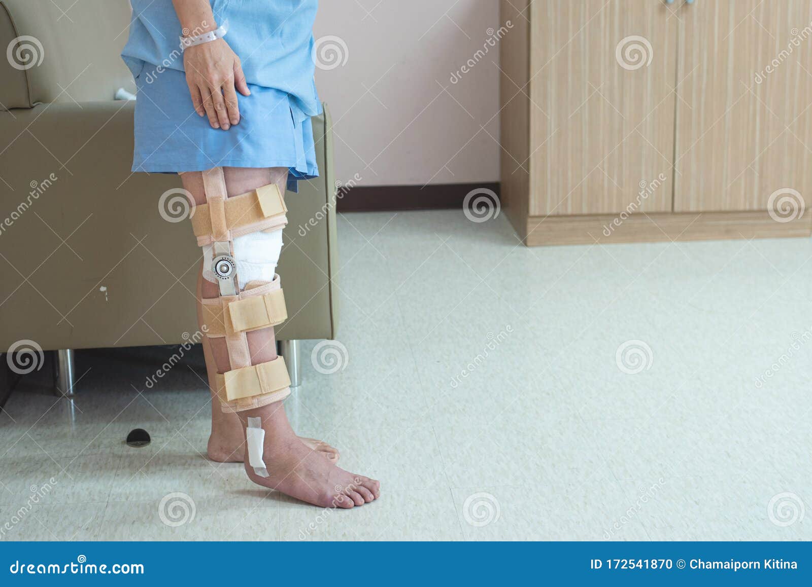 Patient Standing with Support of Knee Brace and Plaster after Pcl Ligament Knee  Surgery in Orthopedic Ward Hospital,recovery and Stock Photo - Image of  orthopedic, care: 172541870