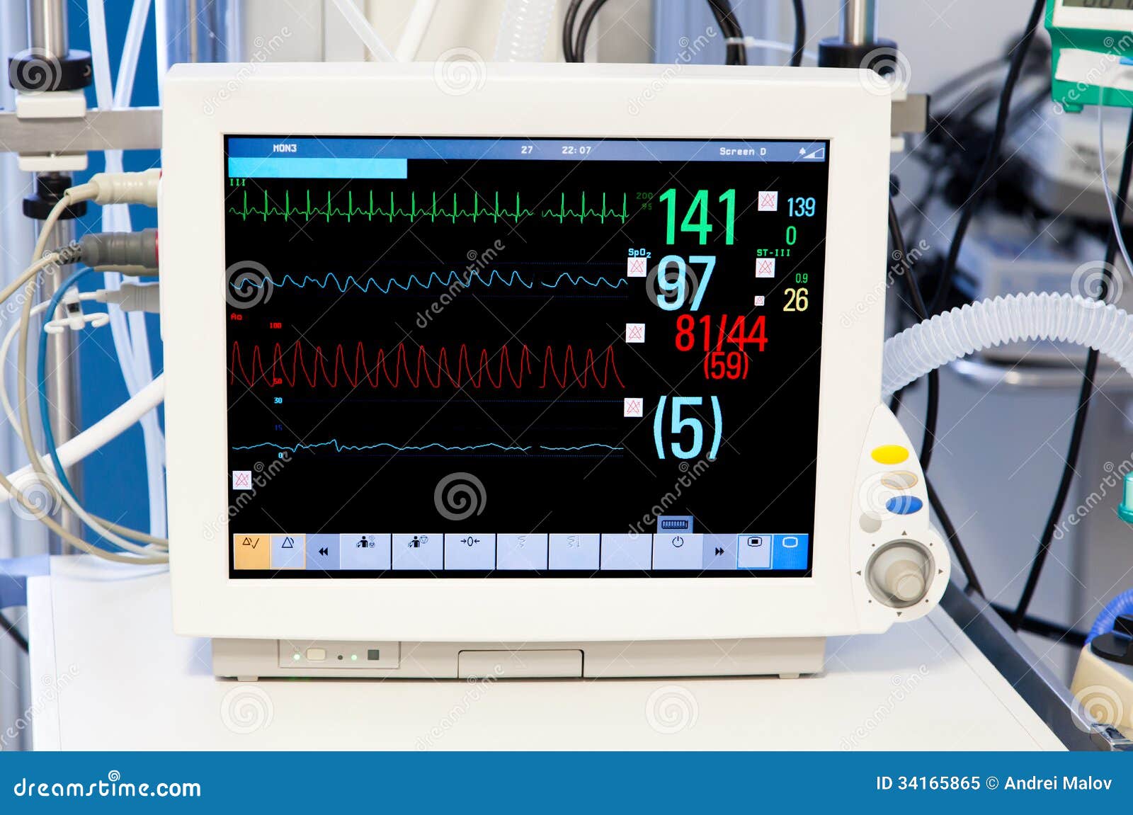 patients monitor in intensive care unit