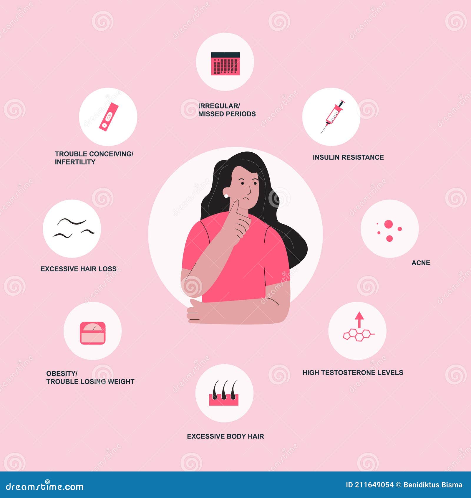 Symptoms Of PCOS Infographics. Detailed Vector Infographics ...