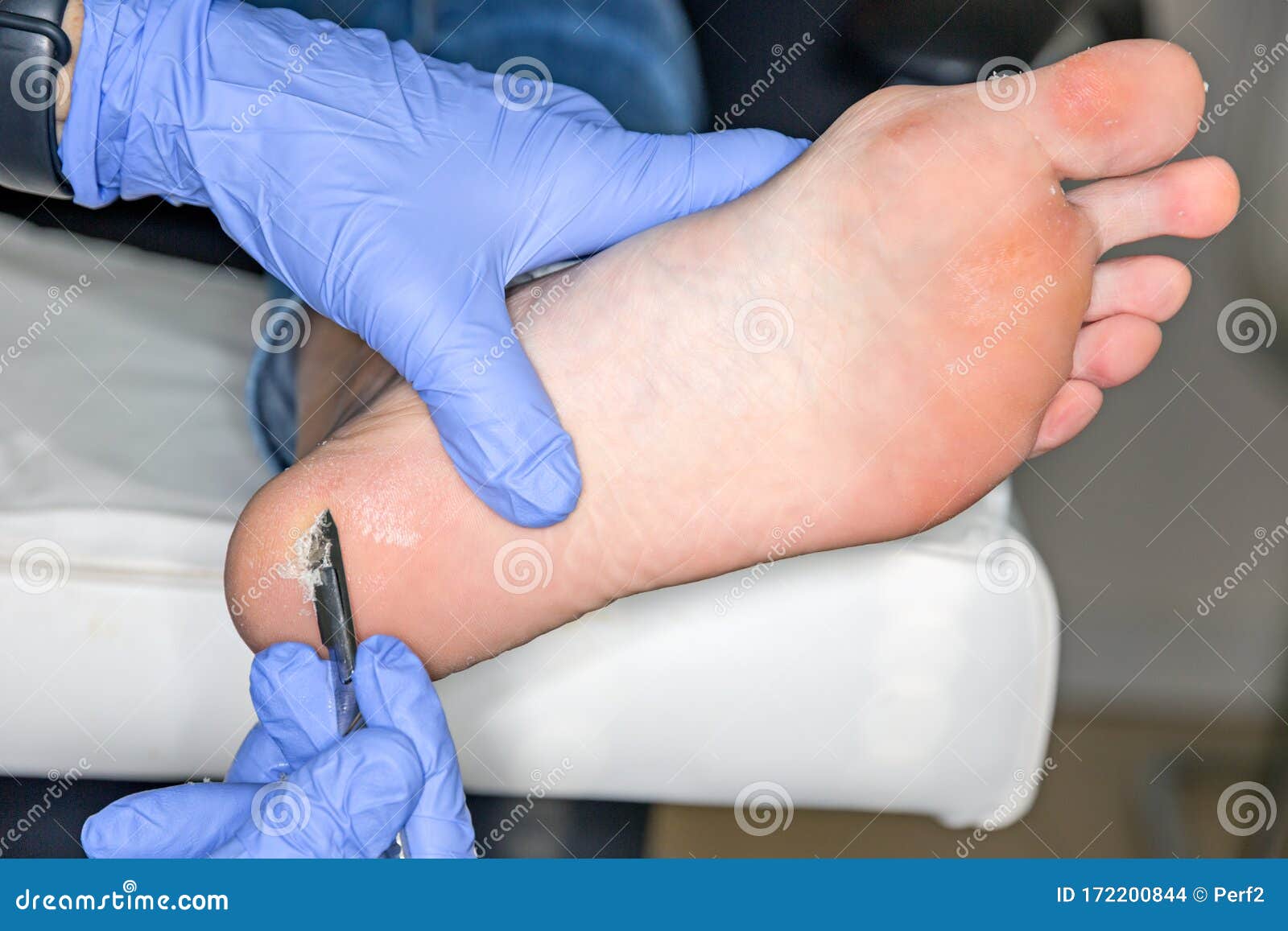 Pedicure stock photo. Image of pedicure, care, health - 172200844