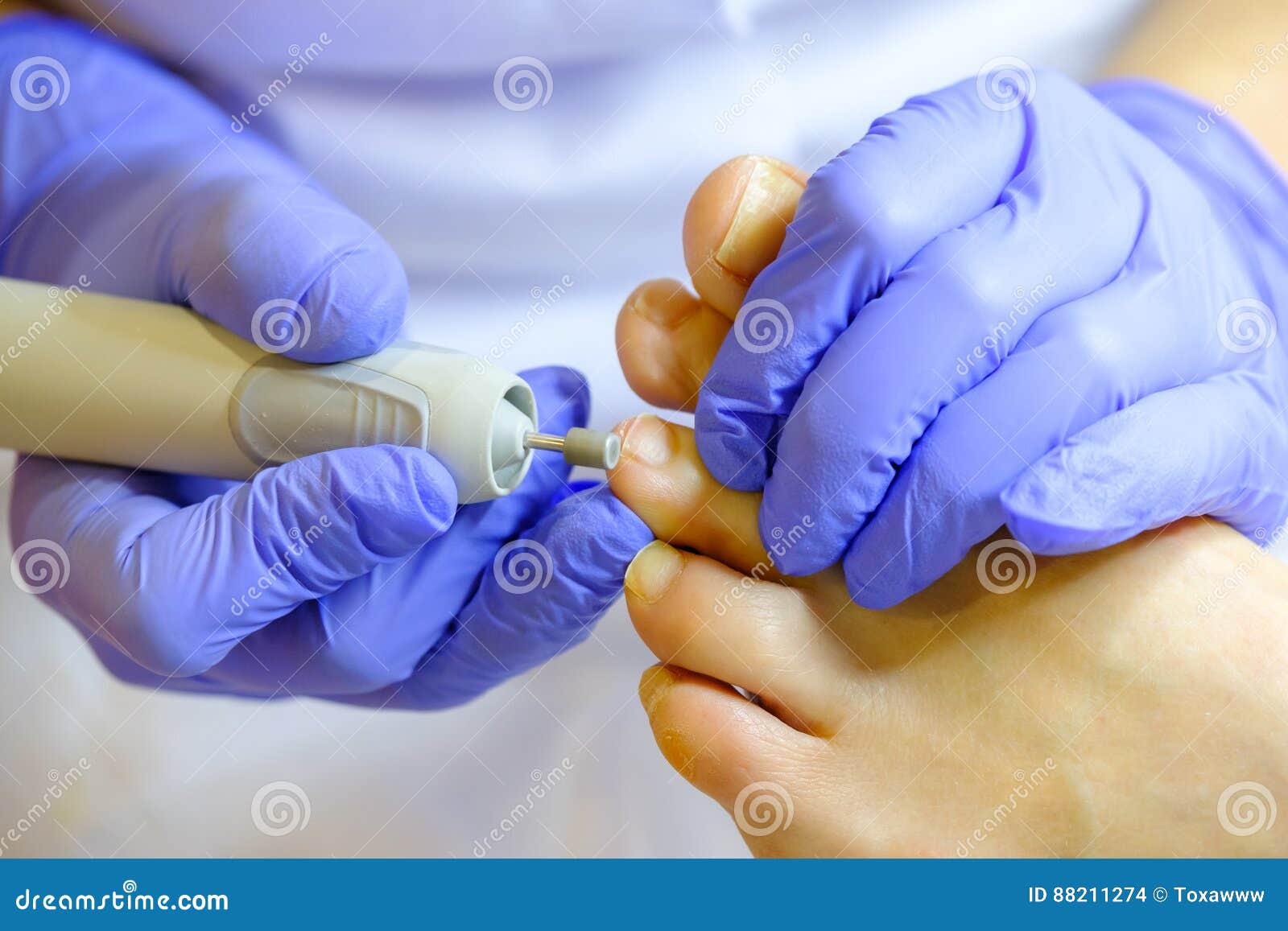 Pedicure Specialist Works with the Patient Stock Photo Image of foot
