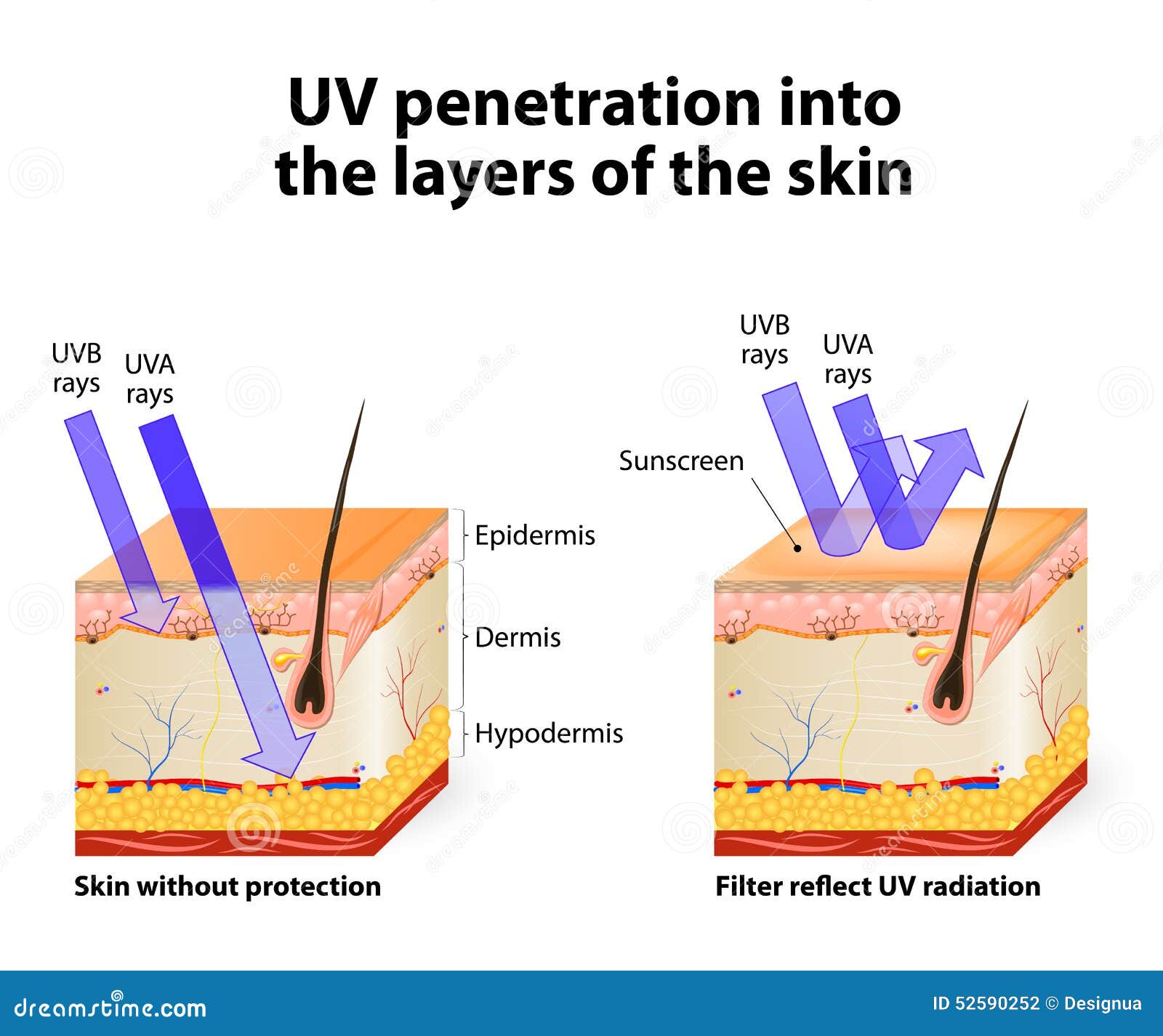 Quella Attinica è Causata Dai Raggi Uv Pelle Umana Dei Raggi Uv Assorbenti E Riflessi Illustrazione Vettoriale