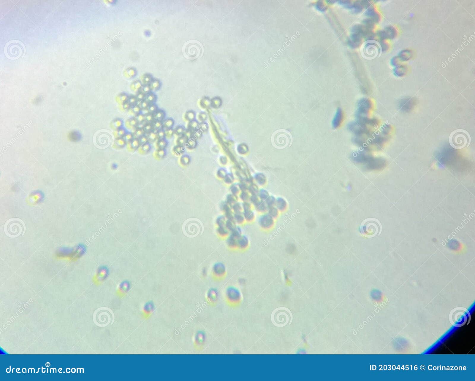 reducir café izquierda Penicillium Genus Moho Esporas Micelio Bajo Microscopio Foto de archivo -  Imagen de fungicida, molde: 203044516