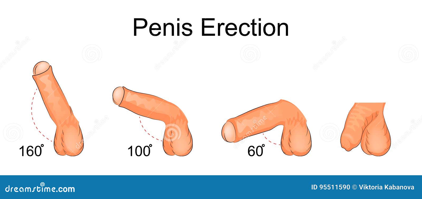 penis jest skręcony z erekcją)