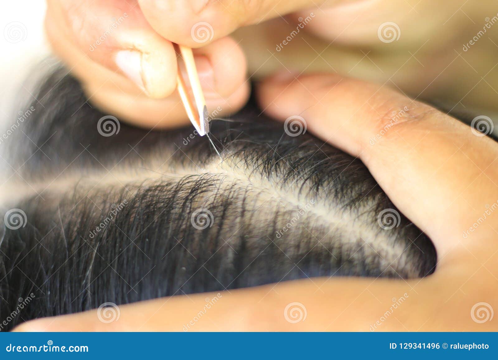 People are Using Tweezers To Pull the White Hair Removal Stock Photo   Image of plucking pull 129341496
