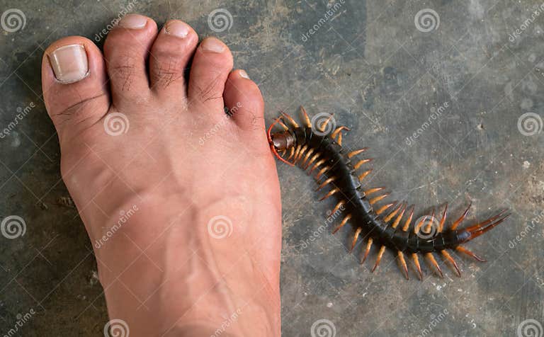 Как выглядит укус сороконожки People Were Bitten by a Centipede on Their Feet Stock Image - Image of animal, p