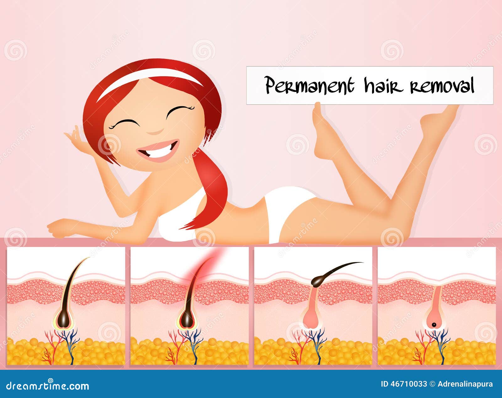 Permanent Hair Removal Stock Illustration Illustration Of