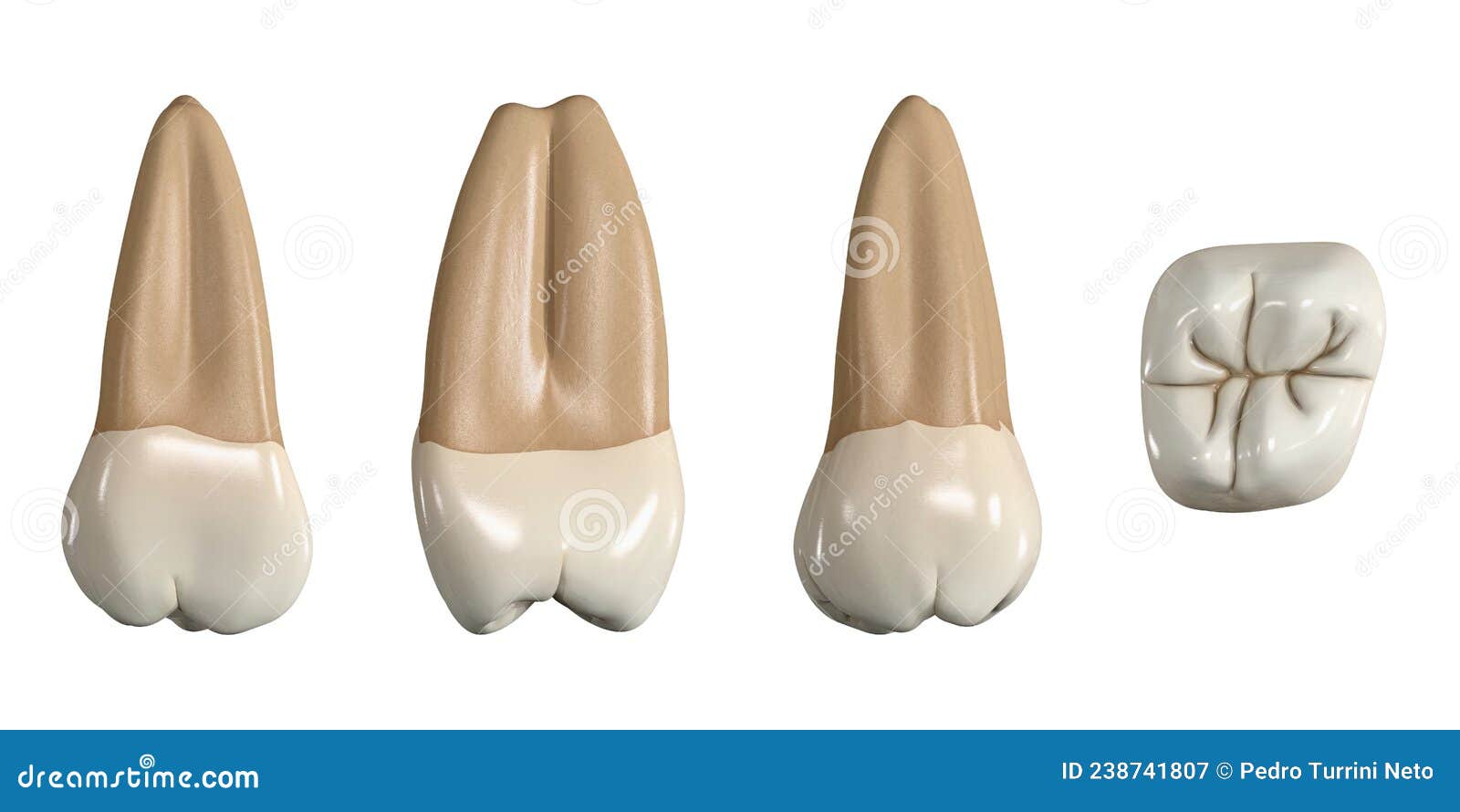 permanent upper third molar tooth. 3d  of the anatomy of the maxillary third molar tooth in buccal, proximal, lingual