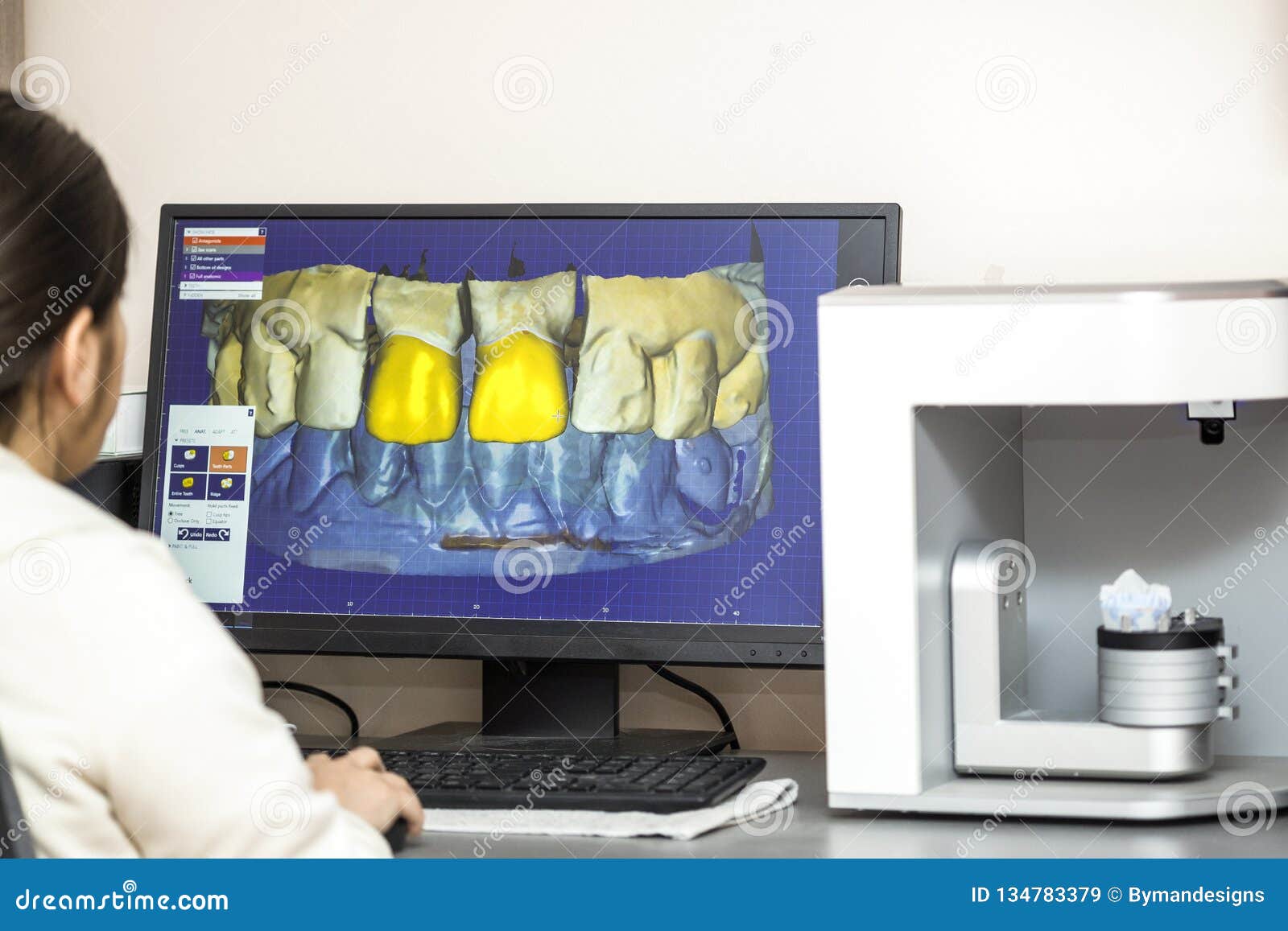 Person Working on Computer with Dental Software Platform for Mak Stock