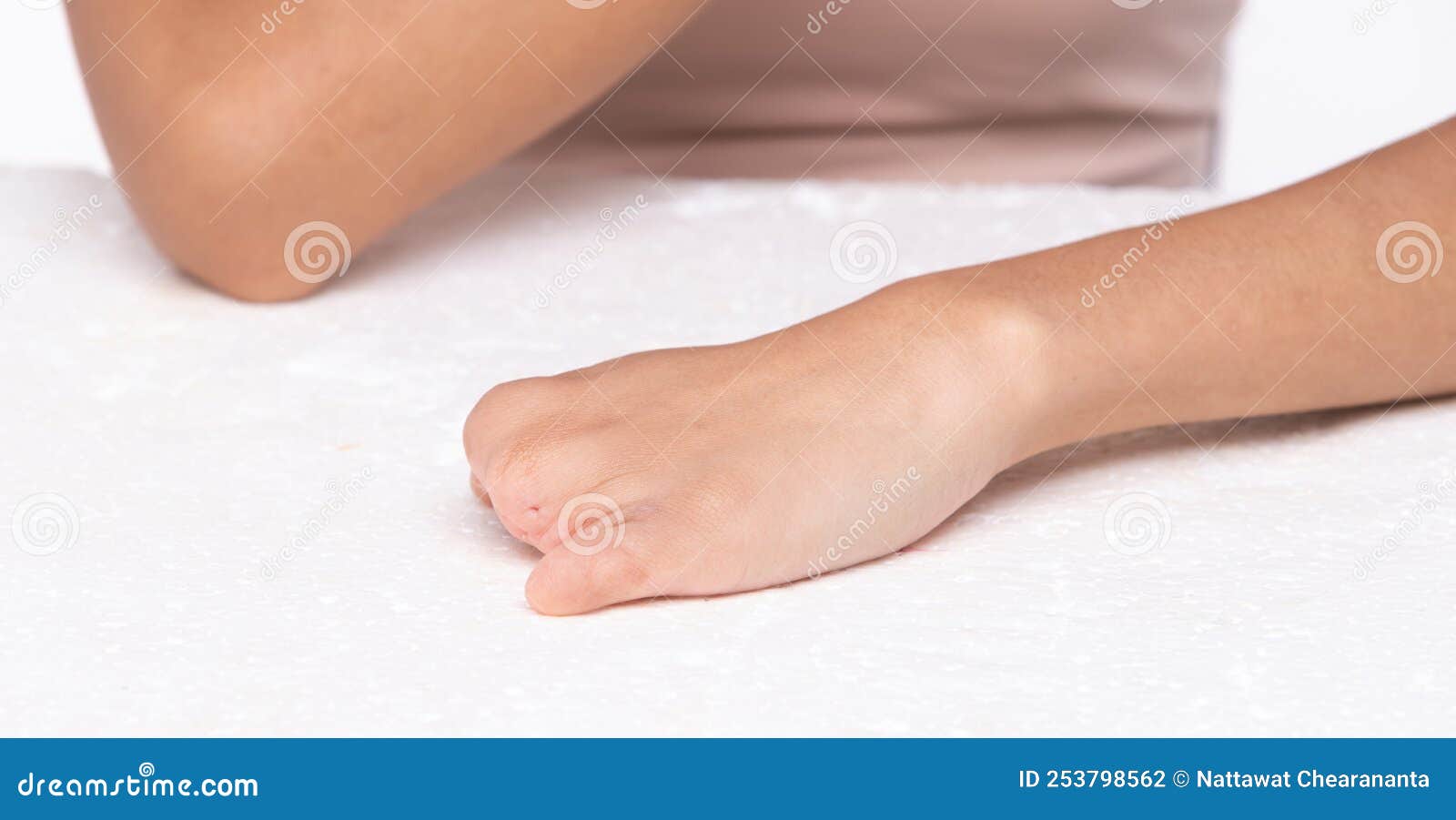 https://thumbs.dreamstime.com/z/persona-discapacitada-mano-sin-dedos-desde-la-infancia-brilla-u%C3%B1a-pulgar-sobre-fondo-blanco-show-de-hembras-mujer-discapacidad-253798562.jpg