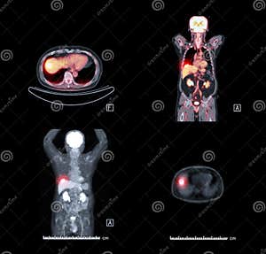 Nuclear Comparison Stock Photo CartoonDealer 121356804 Nuclear Comparison Stock Photo CartoonDealer 121356804