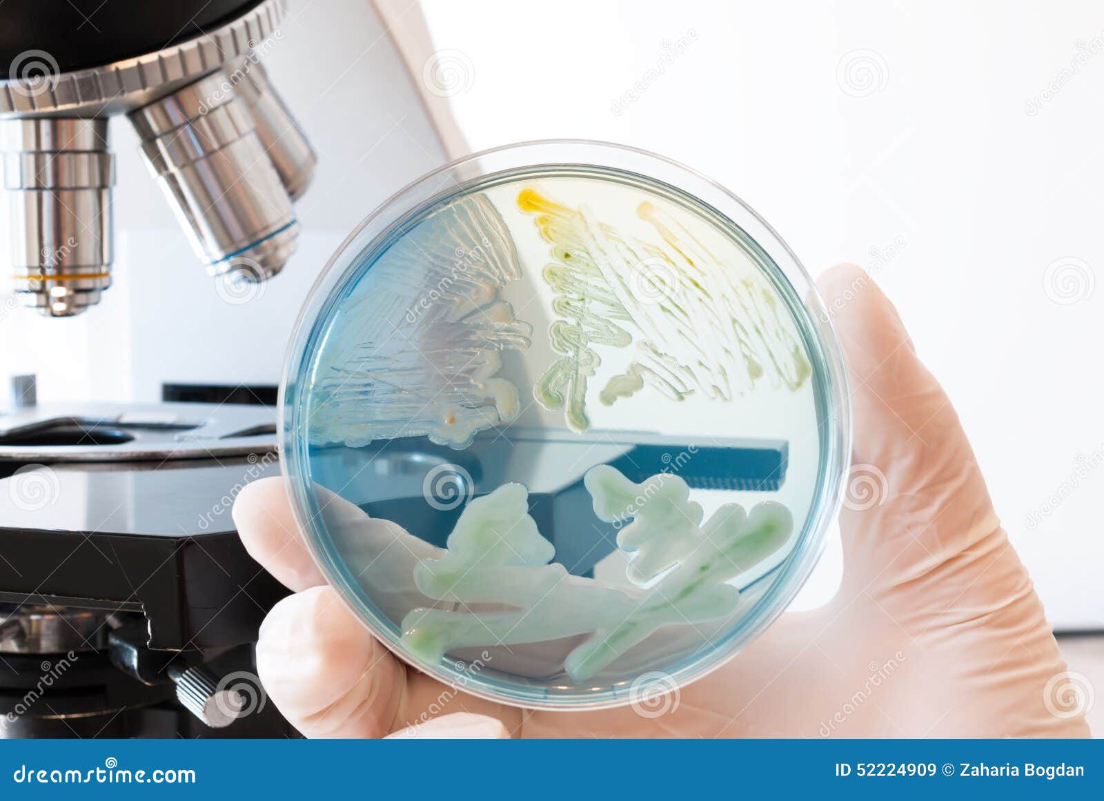 Petri Dish Infected With Different Bacteria In Laboratory Doctor Hand