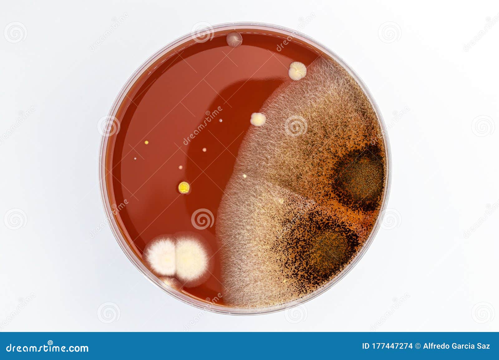 Petri Dish Bacteria Identification