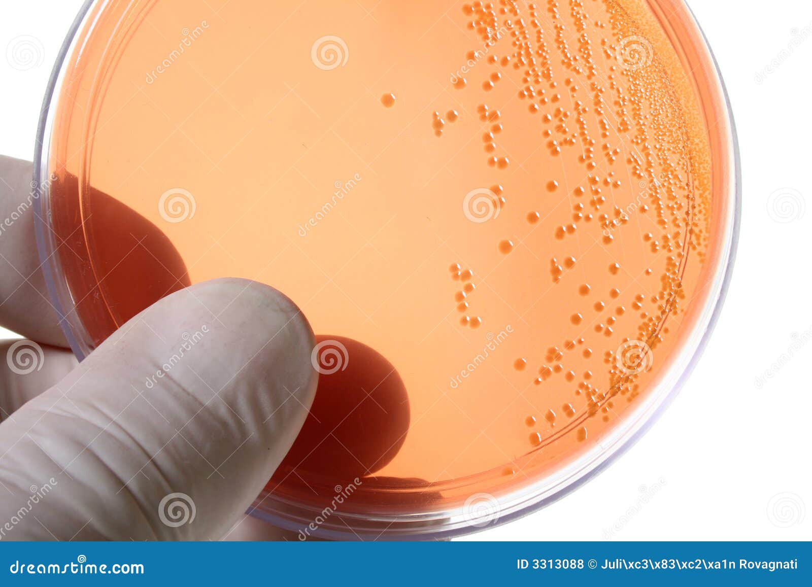 Petri Dishes for Medical Research Stock Photo Image of biotechnology