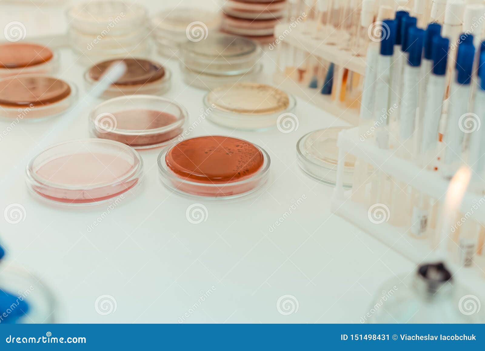 Petri Dishes with Test Samples Standing on the Table Stock Image
