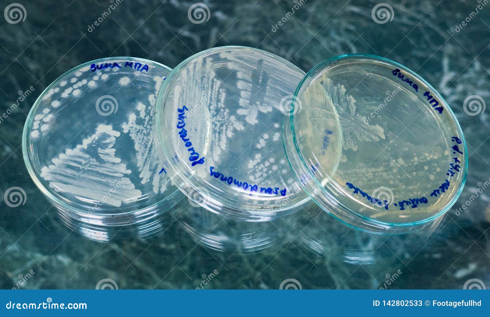 Petri Dishes Under the Microscope Stock Image Image of legionella