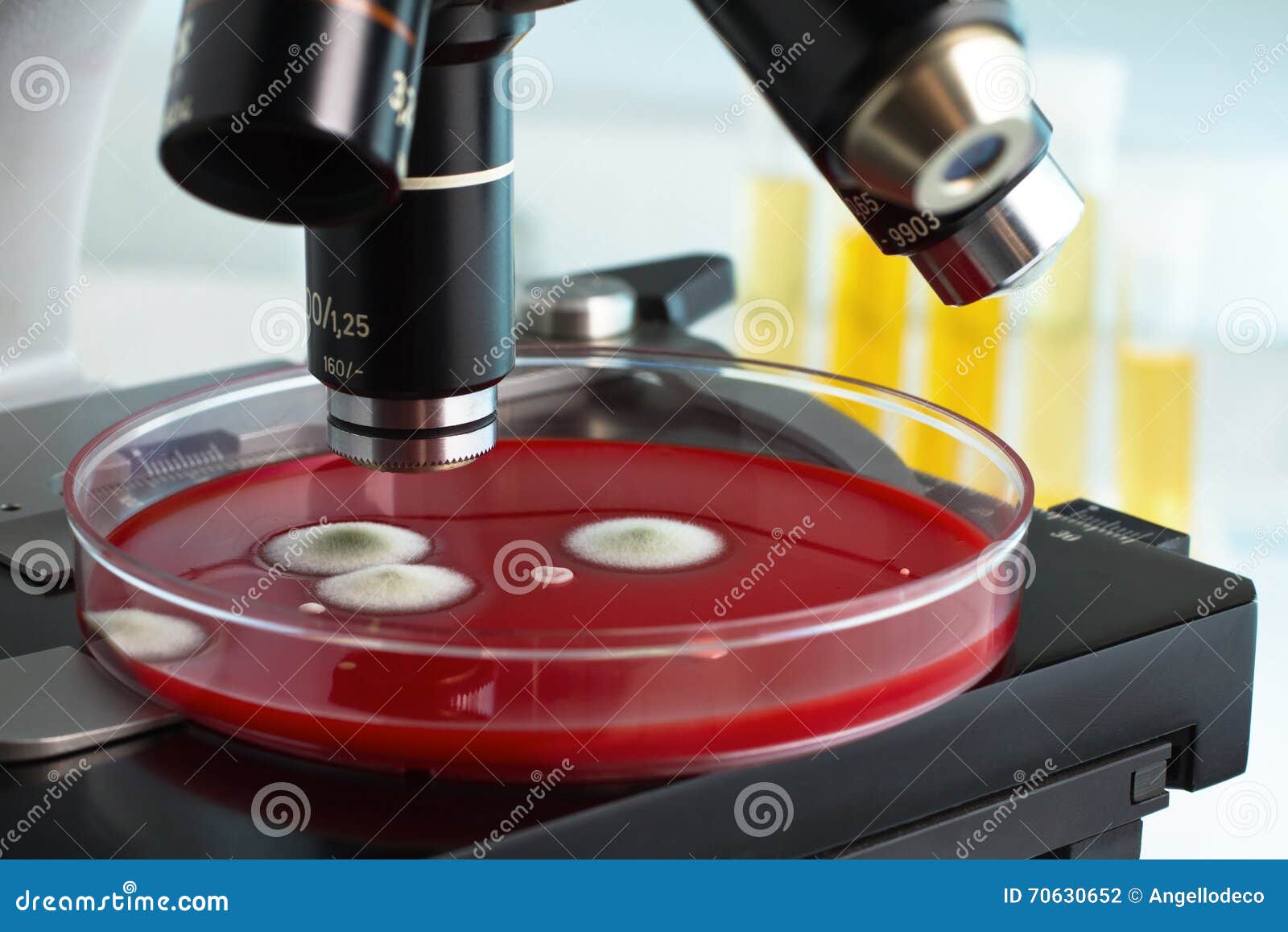 Petri Plate Under in the Laboratory Microscope Stock Photo Image of