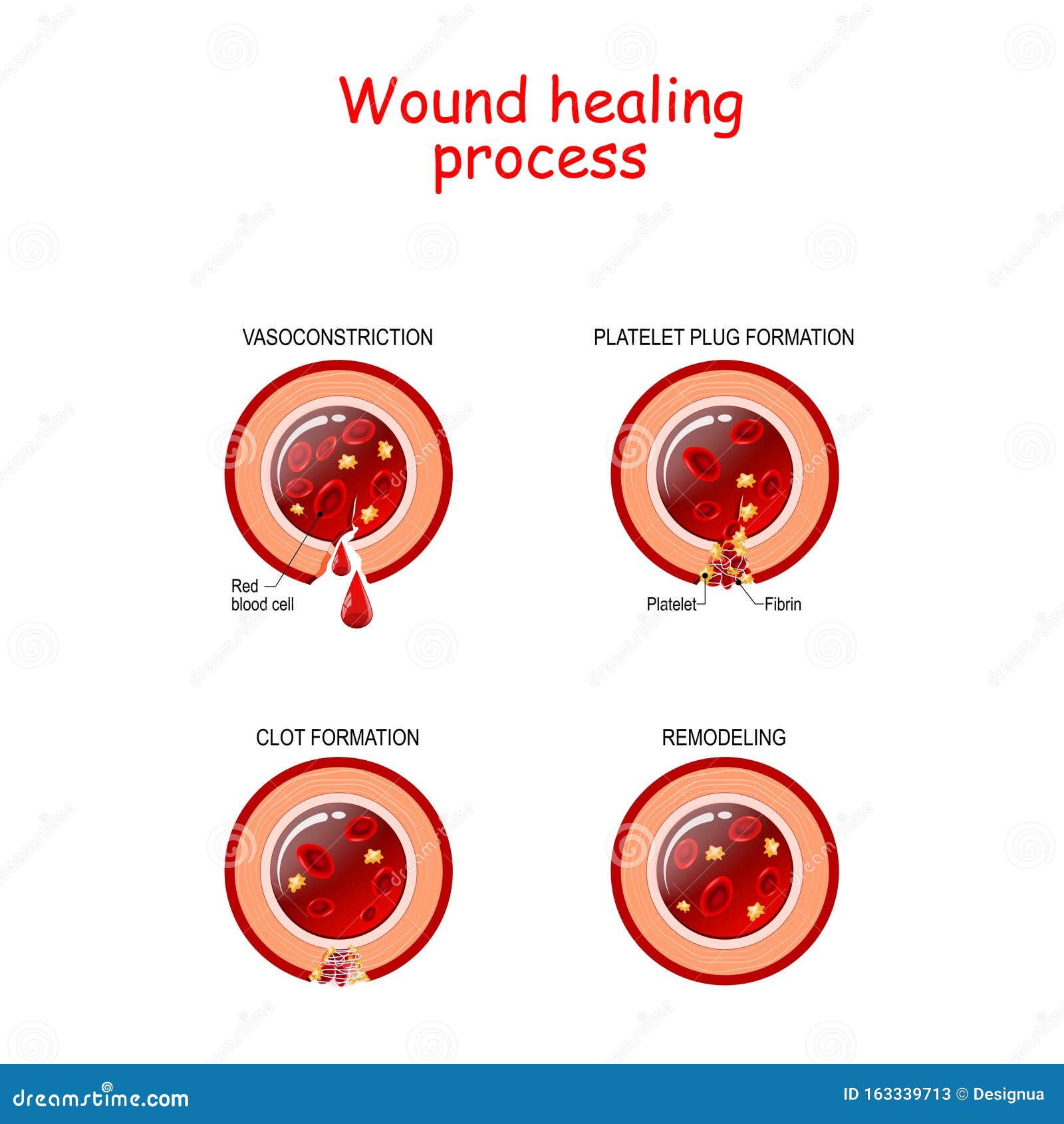 Wound Cartoons, Illustrations & Vector Stock Images - 11754 Pictures to