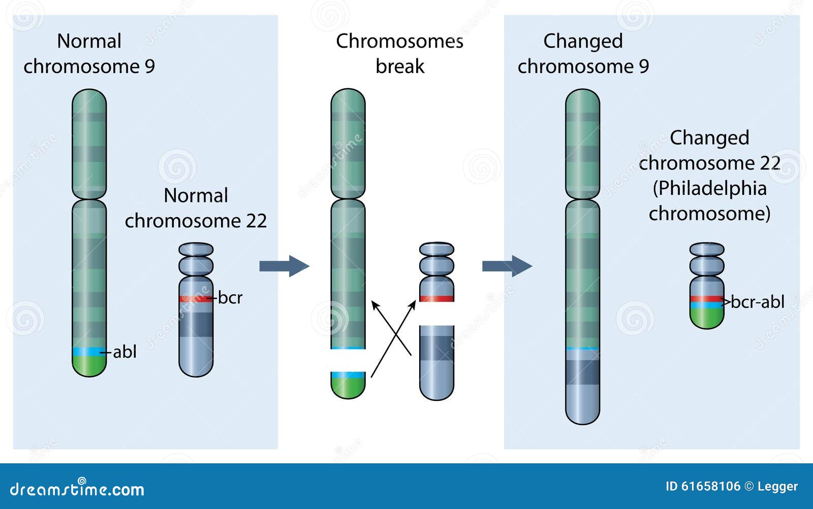 Philadelphia Chromosome Stock Vector - Image: 61658106