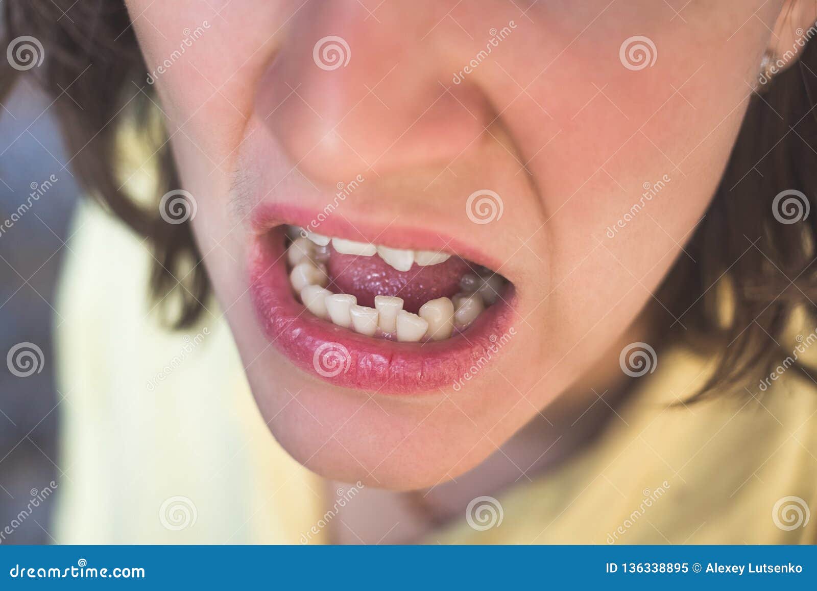 photo of crooked woman teeth