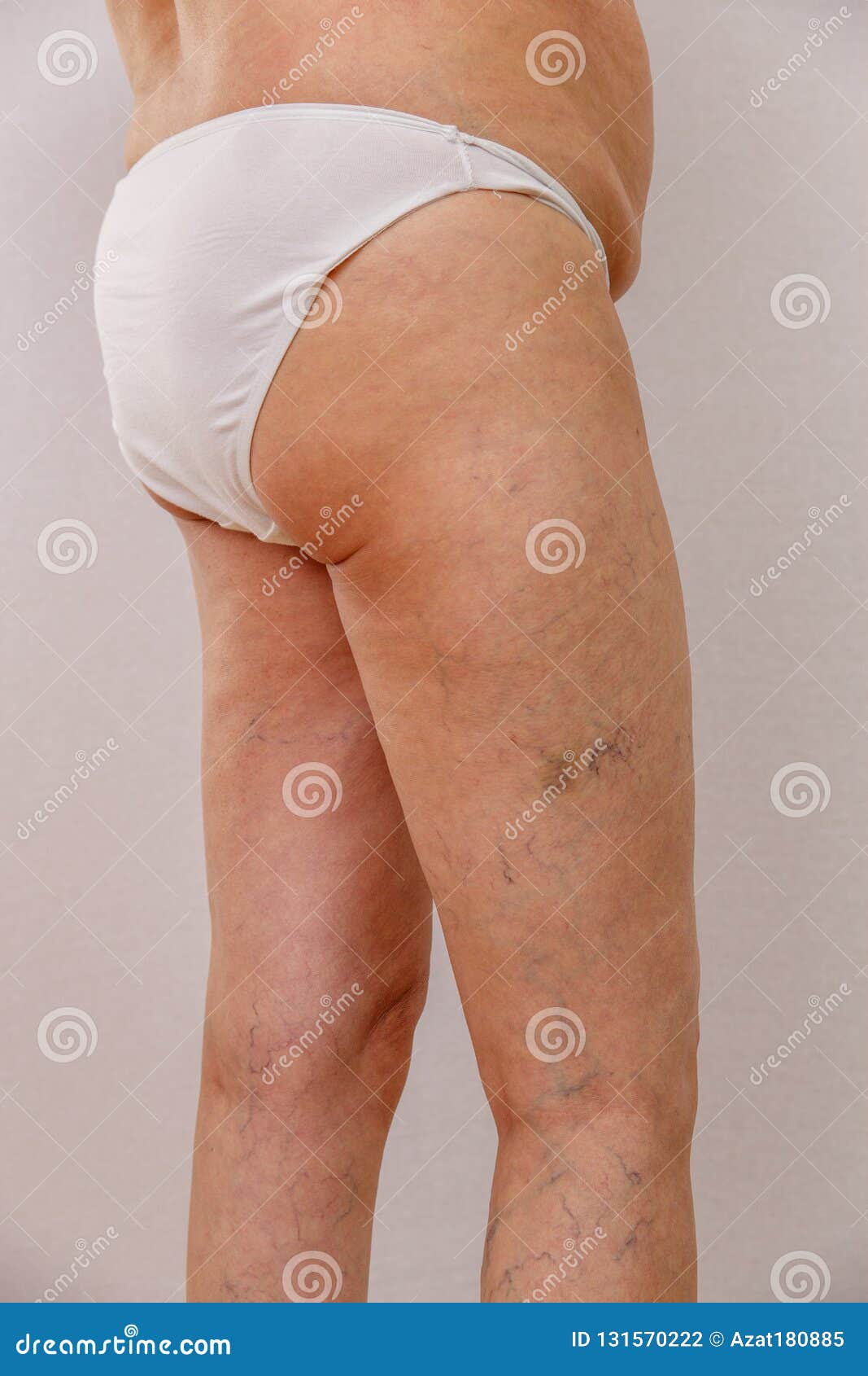 Photo of the Legs and Buttocks of an Old Woman in White Panties with  Cellulite and Varicose Veins on a Light Background. Stock Photo - Image of  body, adult: 131570222