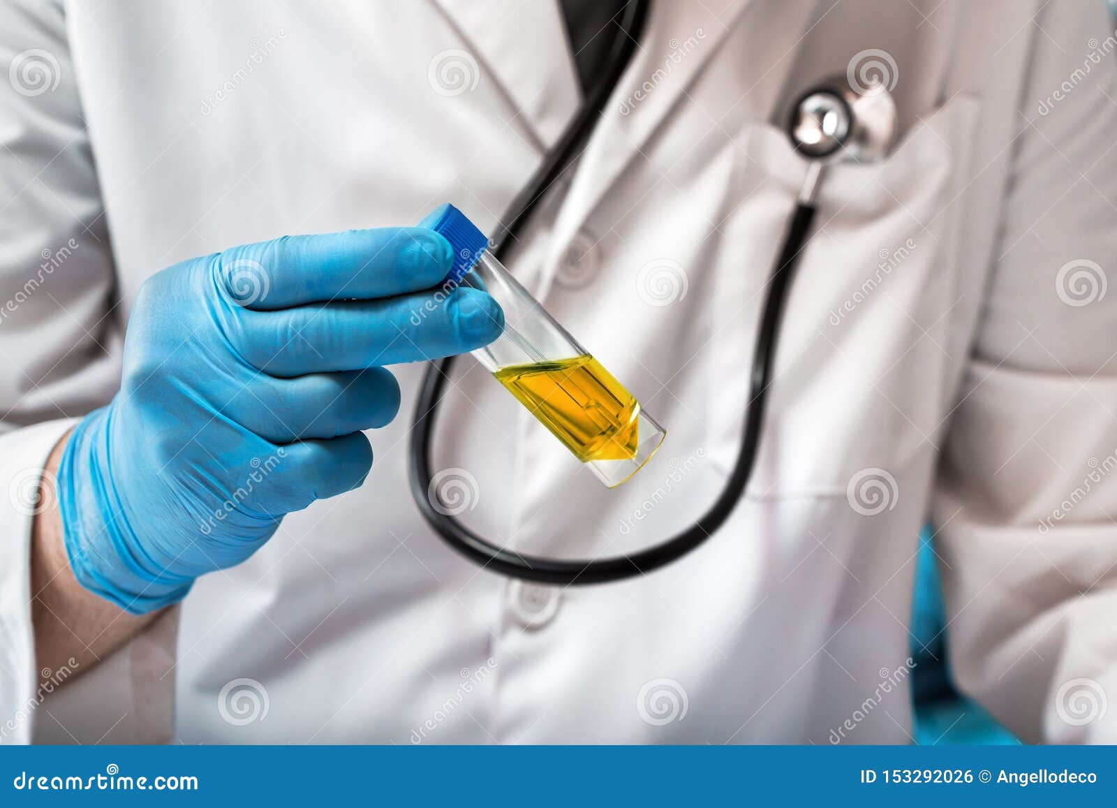 physician with urinalysis for test urea examination