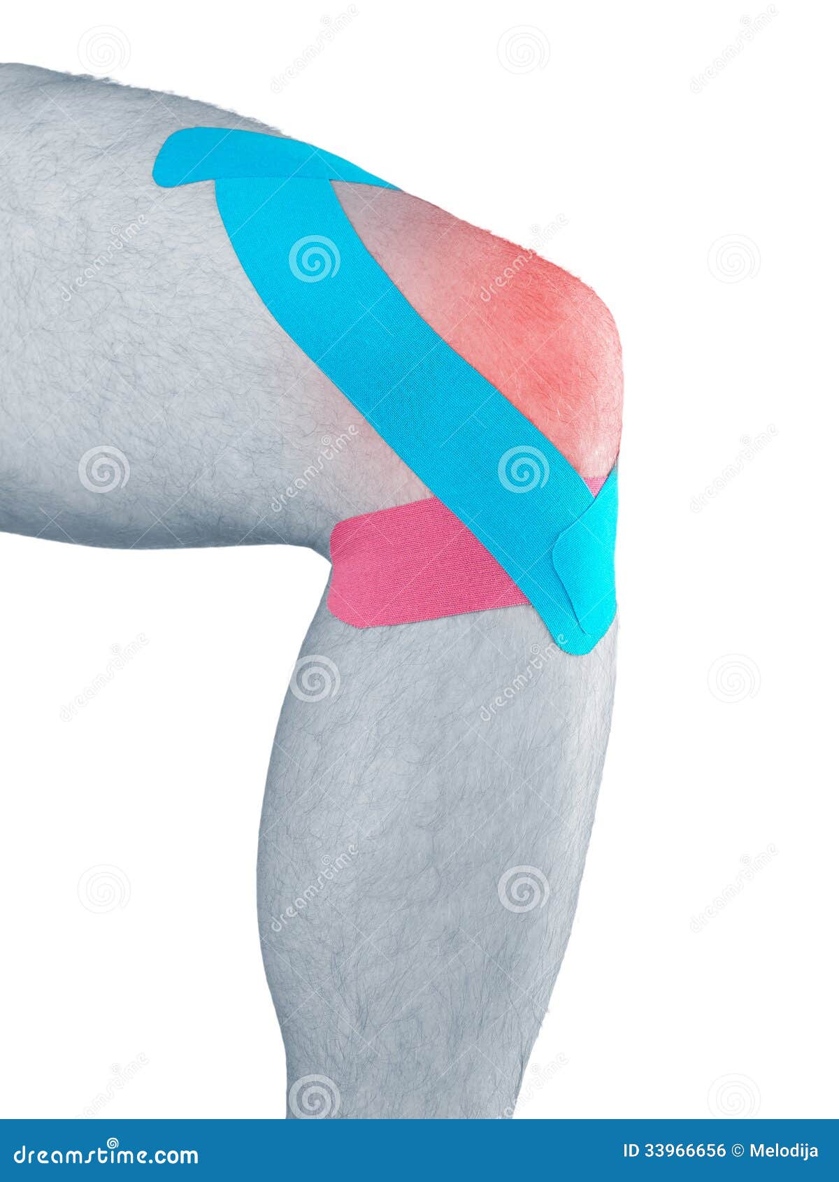 physiotherapy for knee pain, aches and tension
