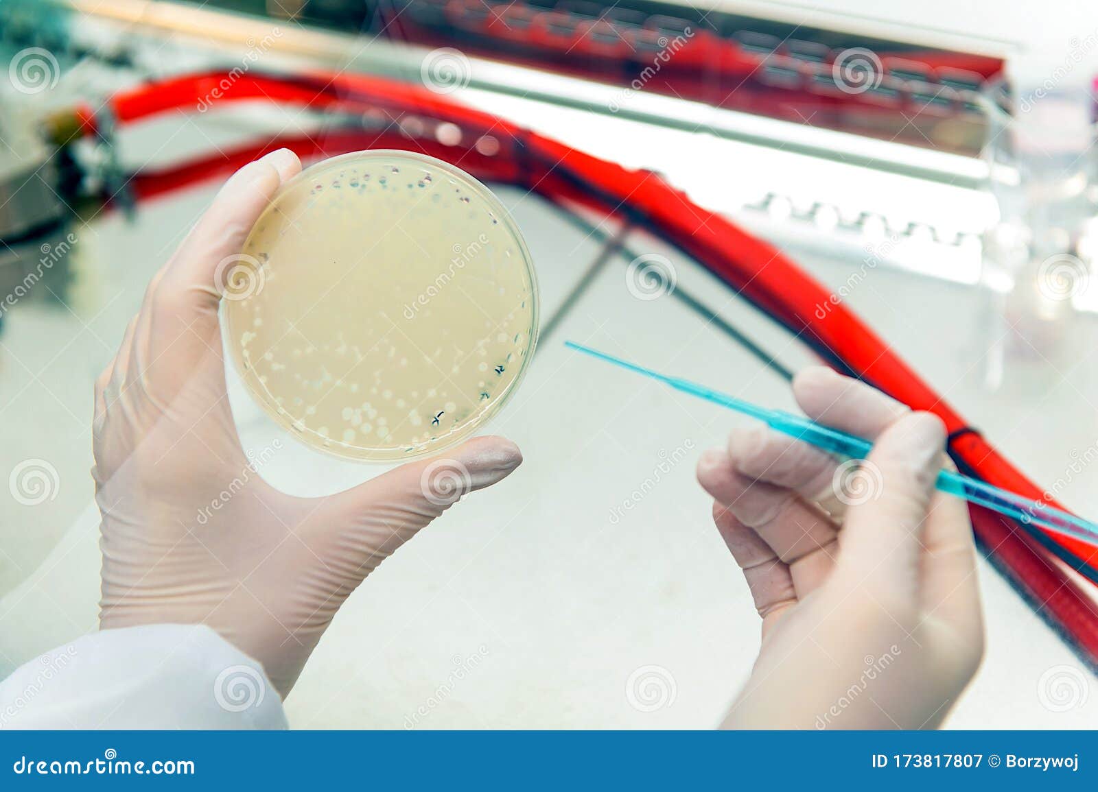 Picking phage plaqe stock image. Image of medicine, microbe 173817807