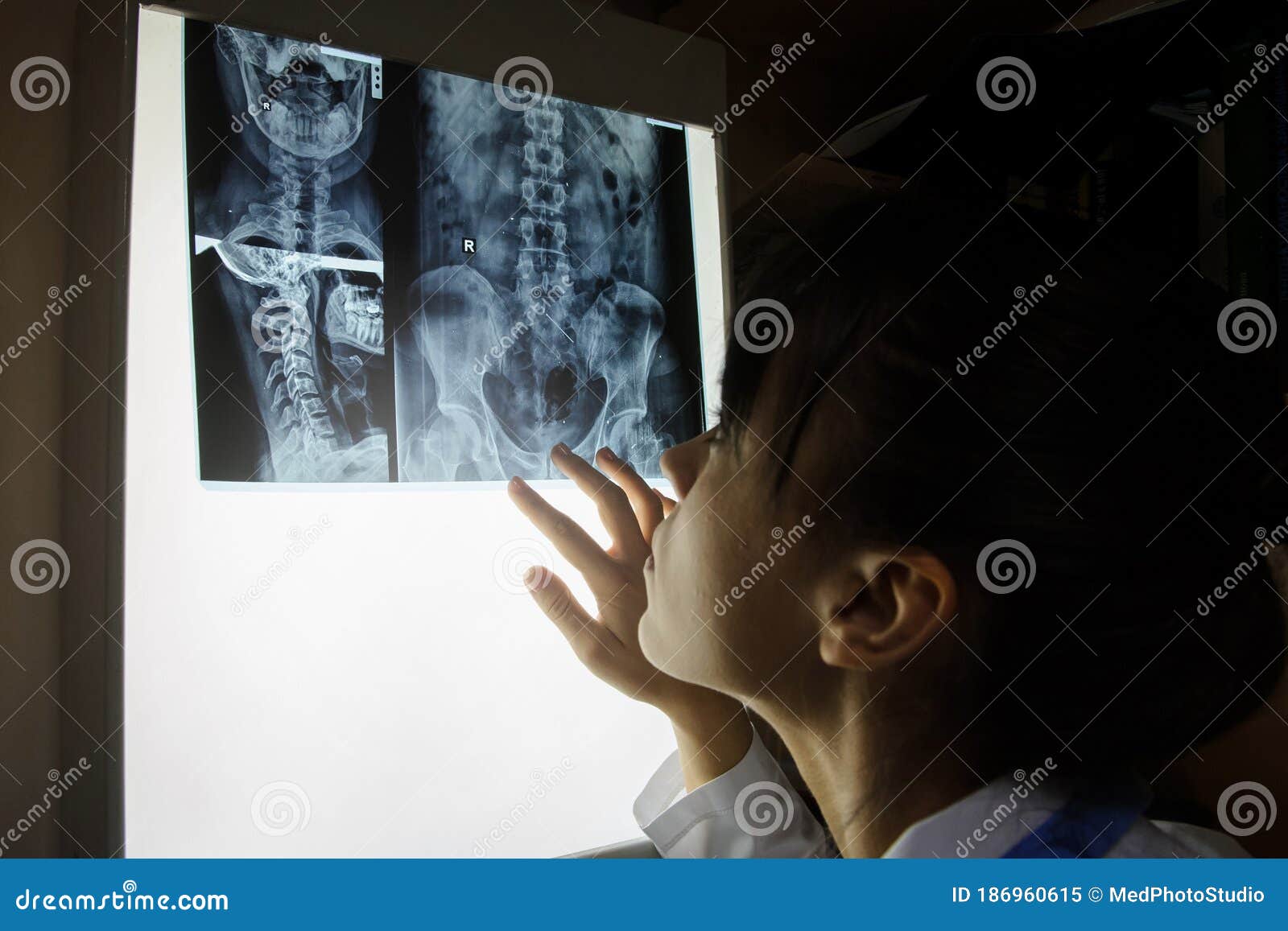 picture of a woman doctor exploring spinal x-ray: lumbar and cervical region