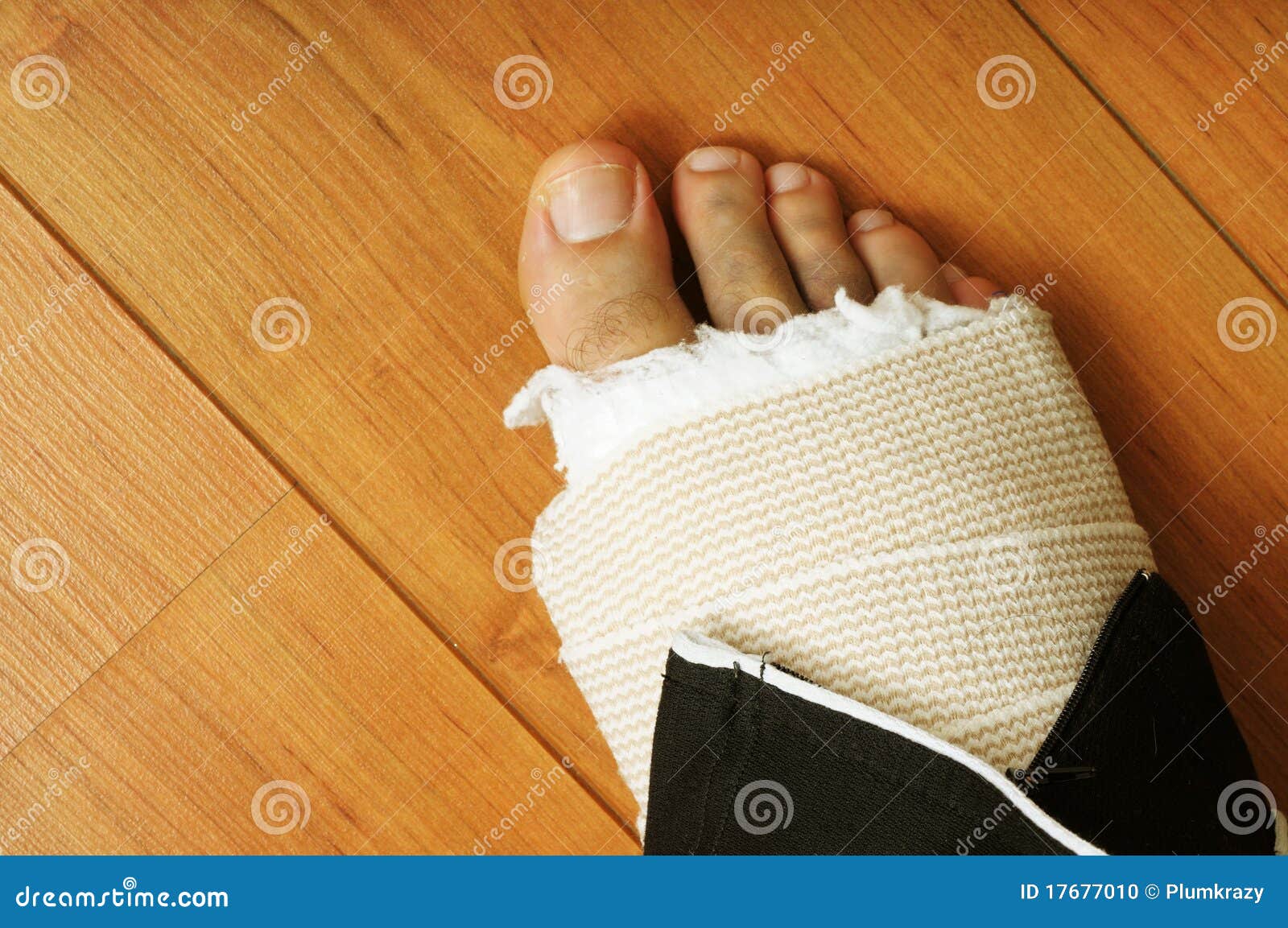 Pied Casse Photo Stock Image Du Sante Bandage Casse Pied Casse Photo Stock Image Du Sante Bandage Casse