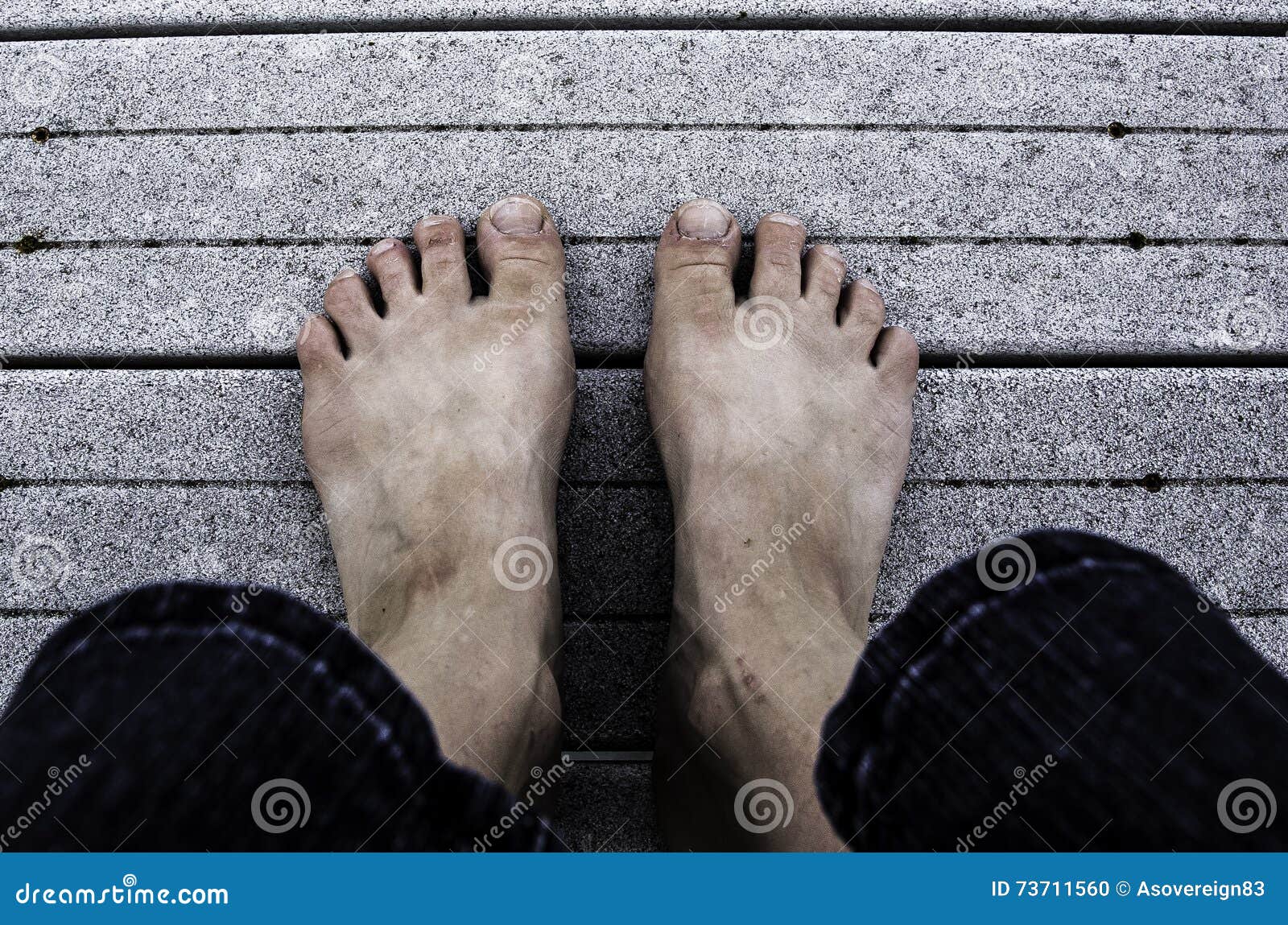 Pies feos foto de archivo. Imagen de descubierto, necesidad - 73711560