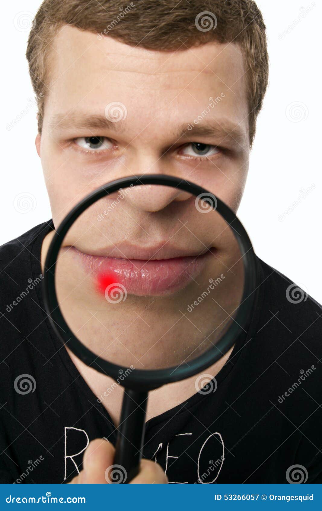 pukkel op lip pukkel op lip