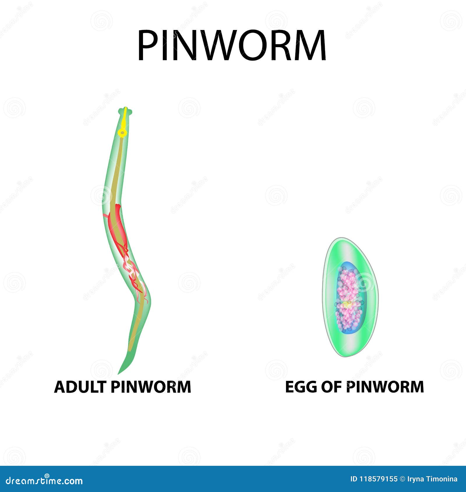 pinworms tenni)