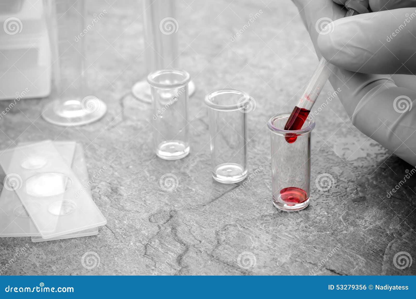 Pipette blood samples stock photo. Image of health, cure 53279356