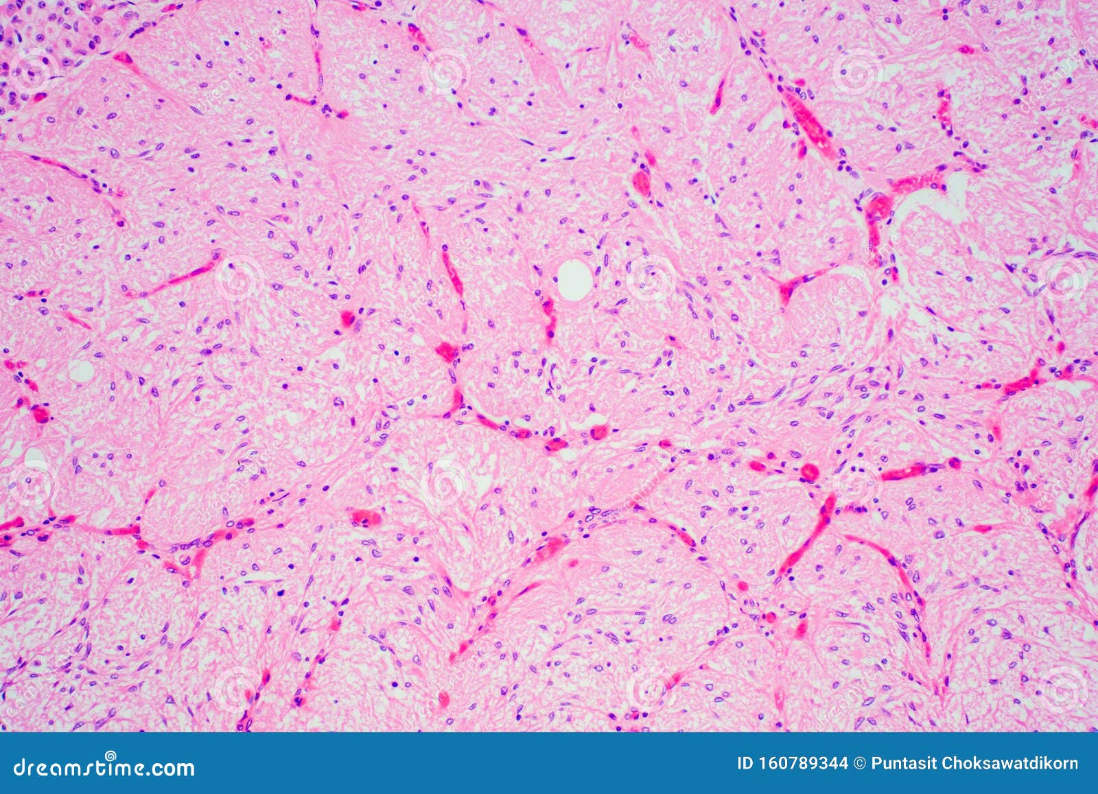 Pituitary Gland Stock Photo Biology Diagrams