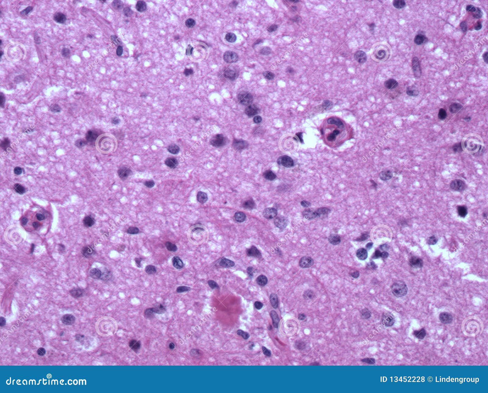 Plaque cells2 photo stock. Image du brouille, science 13452228