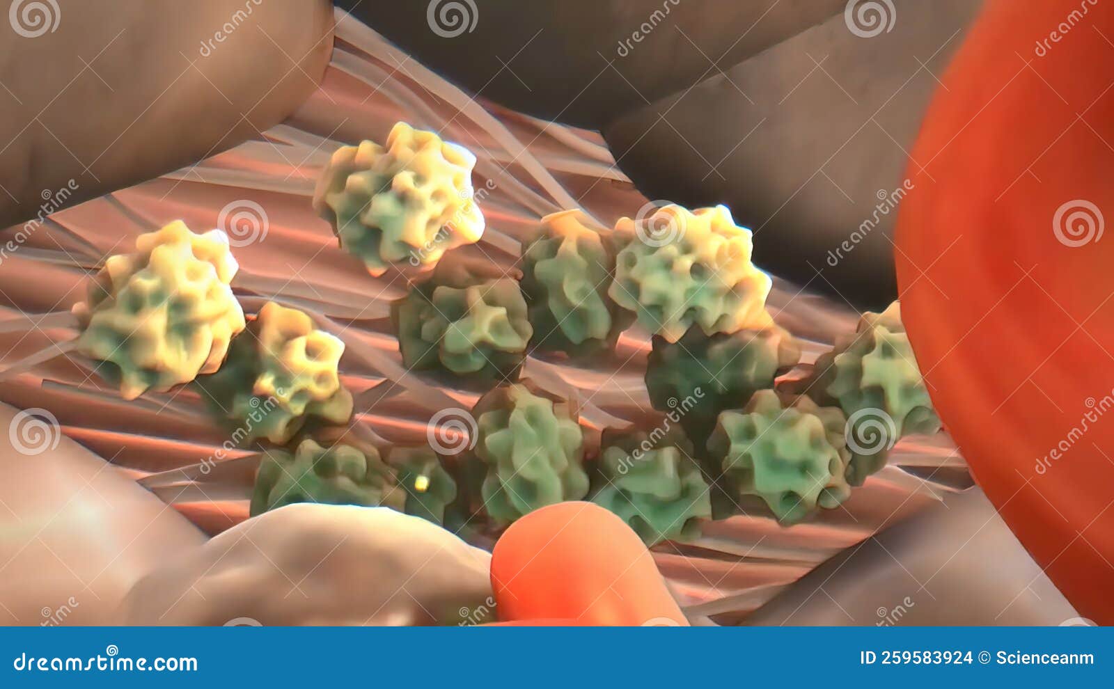 Plaque Formation in the Cardiovascular System Stock Illustration