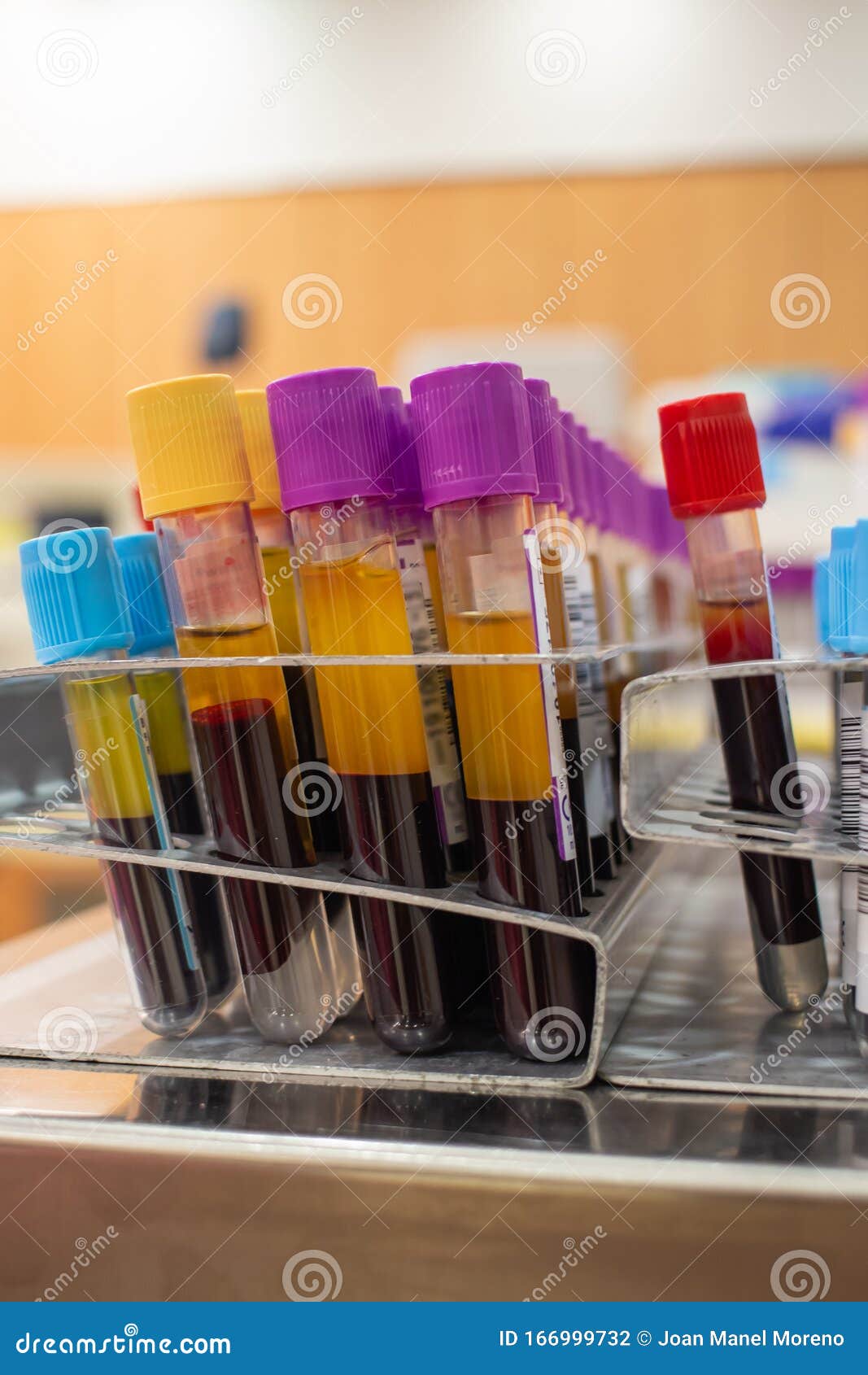 Plasma Test Tubes in a Blood Donor Medical Center  Stock Photo Image Plasma Test Tubes in a Blood Donor Medical Center  Stock Photo Image