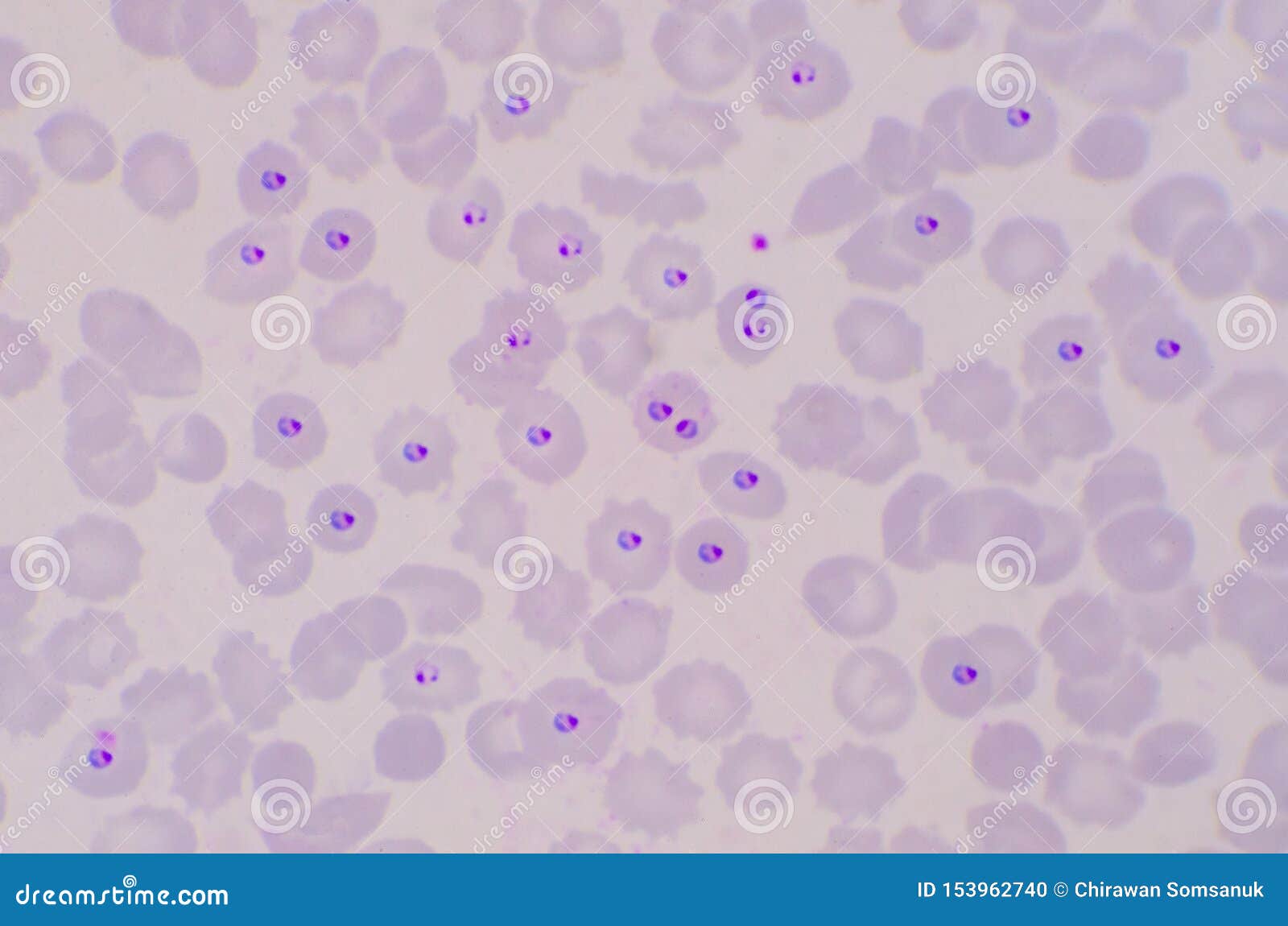 Blood and Tissue Protozoa | Basicmedical Key