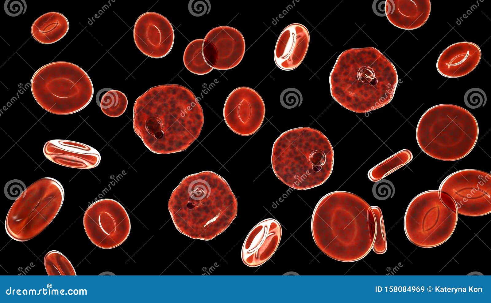 Red Blood Cells Infected With Malaria Parasite Plasmodium Vivax, Ring-form  Trophozoite Stage, 3D Illustration Stock Photo, Picture and Royalty Free  Image. Image 130794009.