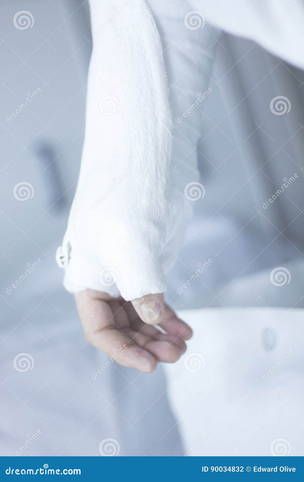 plaster bandage hand casting plaster bandage hand casting