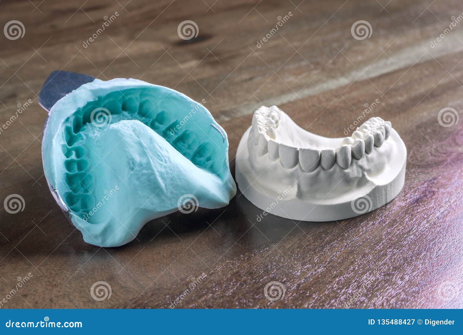 Plaster Cast Molds of the Upper and Lower Jaws Stock Image - Image of  manufacture, prosthesis: 135488427
