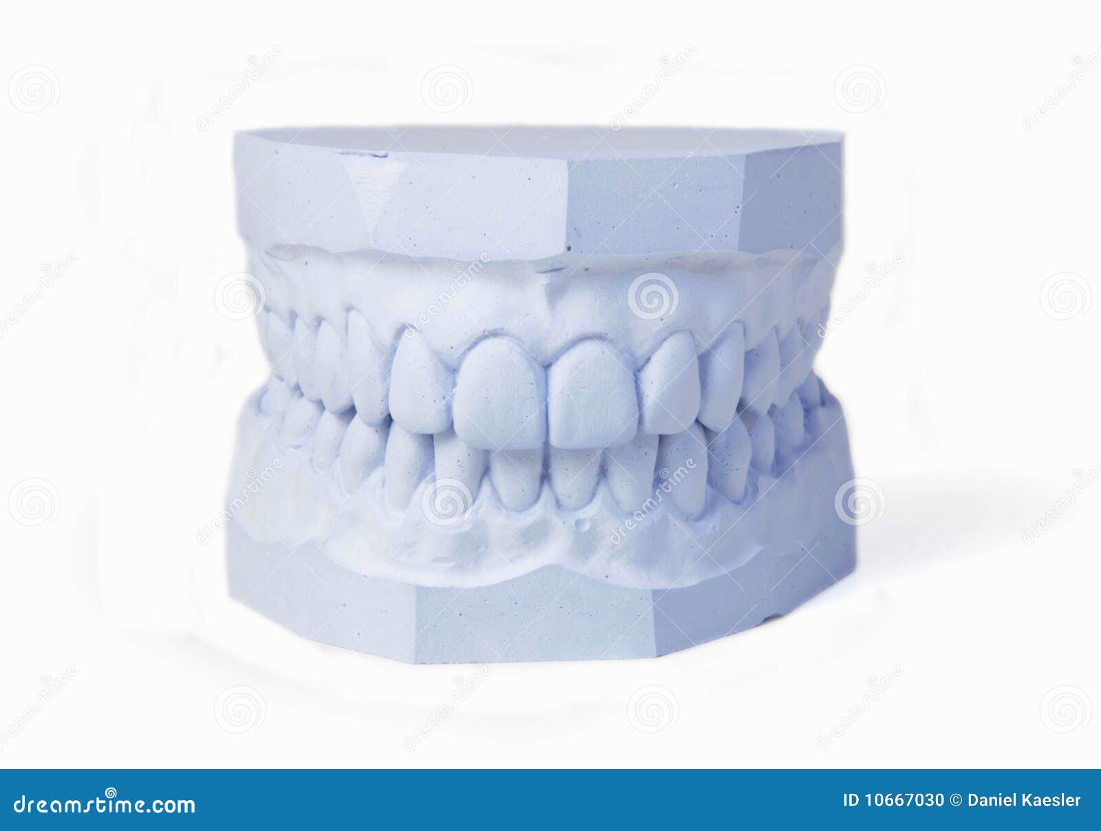 Plaster Cast Of Jaws. Dental Casting Gypsum Model Human Jaws In
