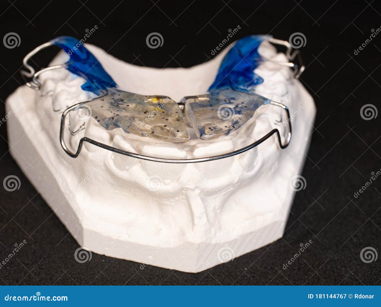 Orthodontic Cast Of Human Jaw For Prosthetics And Braces.Ceramic Crown
