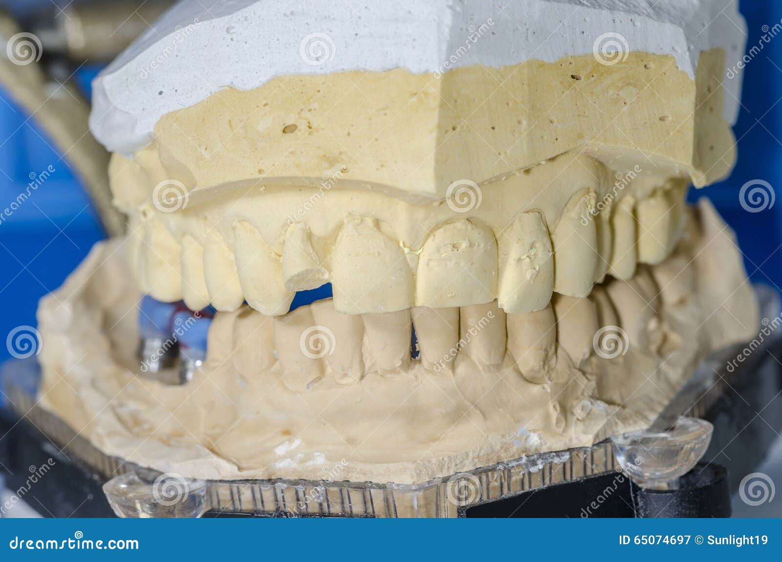 Plaster dental mold. stock image. Image of endodontics 65074697