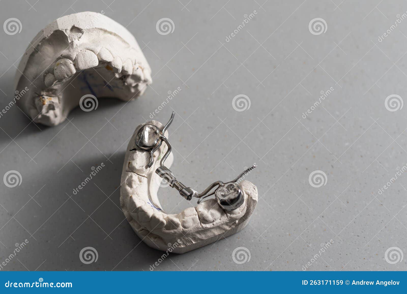 Plaster Models of Dental Prostheses. Demonstration Models of Dentures