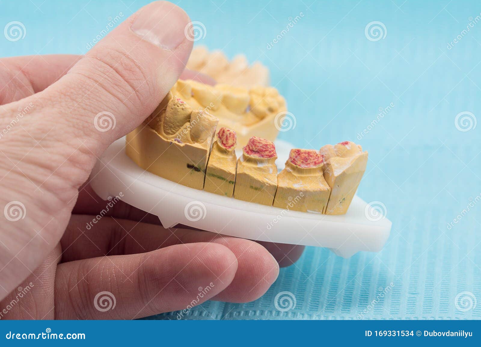 Plaster Models Of The Jaws In The Hands Of A Dental Technician In A