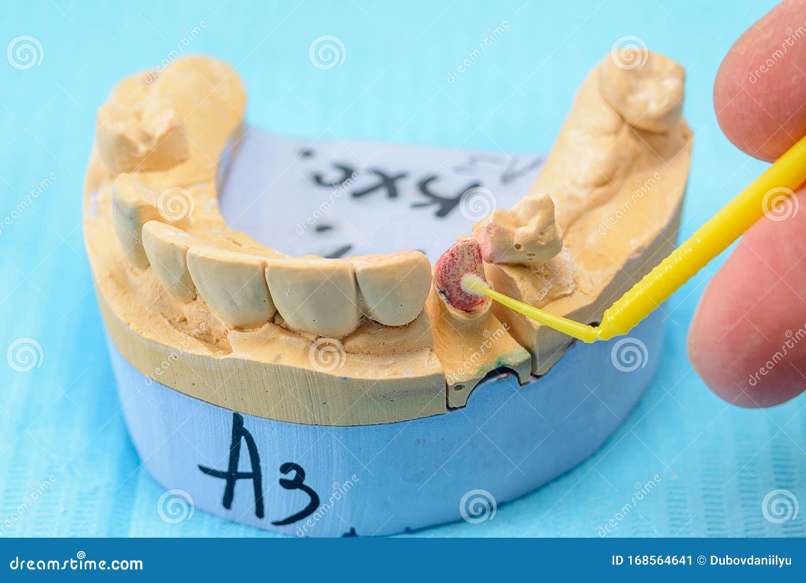 Plaster Models of the Jaws in the Hands of a Dental Technician in a