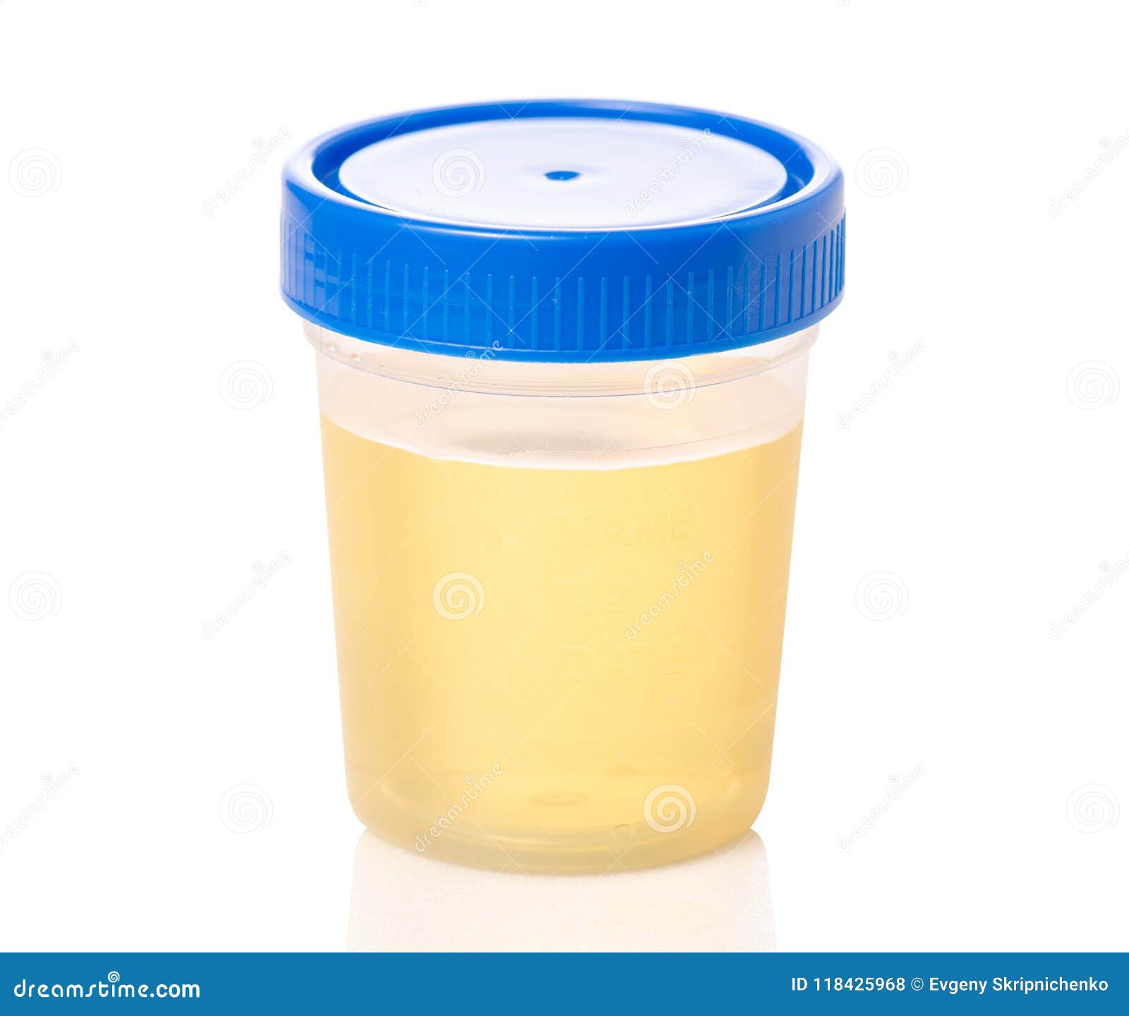 Plastic Container with Urine Analysis Stock Photo Image of chemical