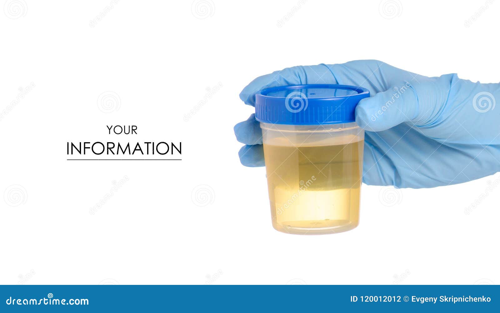 Plastic Container with Urine in Hand Analysis Pattern Stock Photo